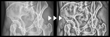 AIリアルファインダーを使った画像処理例6ボタン