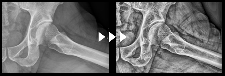 AIリアルファインダーを使った画像処理例5ボタン