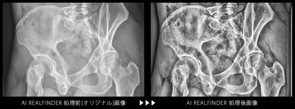 AIリアルファインダーを使った画像処理例6 /