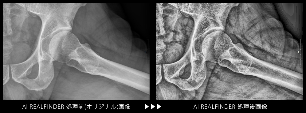 AIリアルファインダーを使った画像処理例5 /